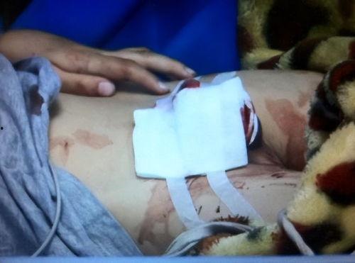 割生殖器视频,生殖器割除视频引发的伦理争议