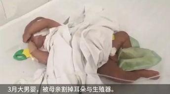 割生殖器视频,生殖器割除视频引发的伦理争议